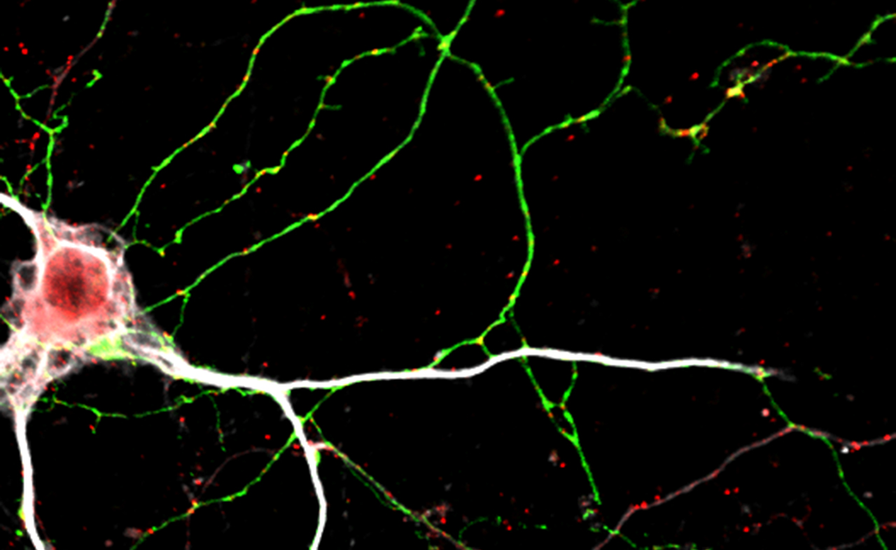 Neuron
